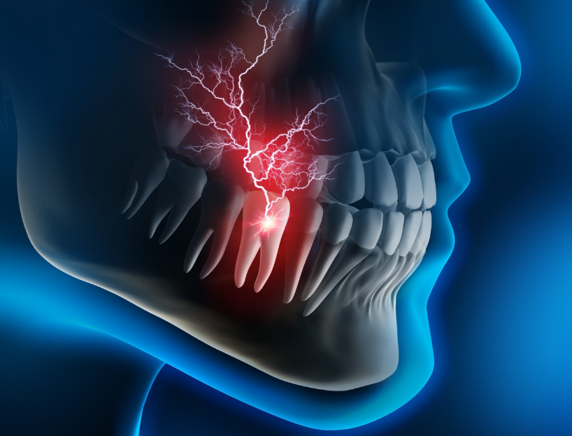 Pain in wisdom tooth