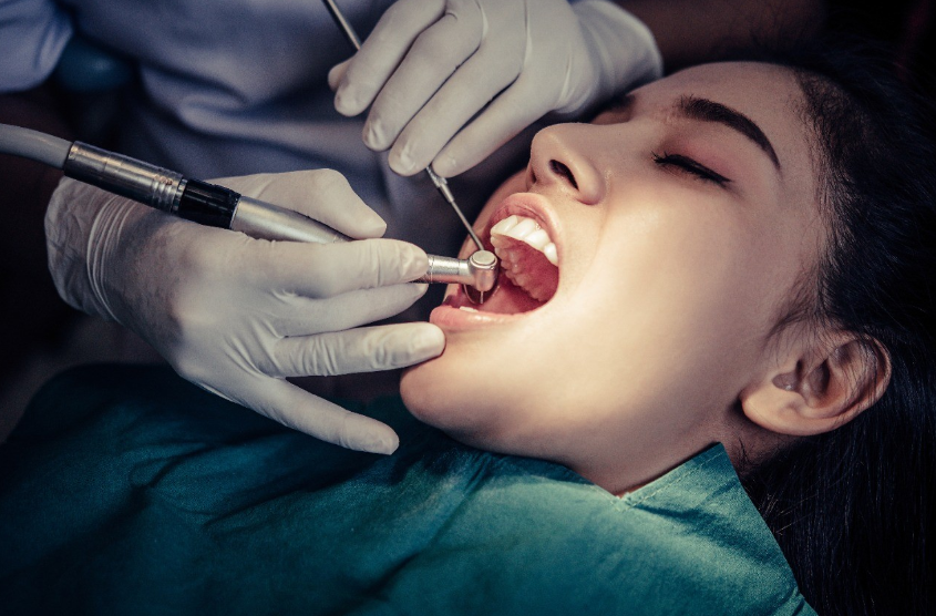 What is the Advantage of a Root Canal?