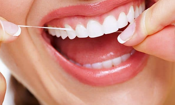 Food lodgement in teeth