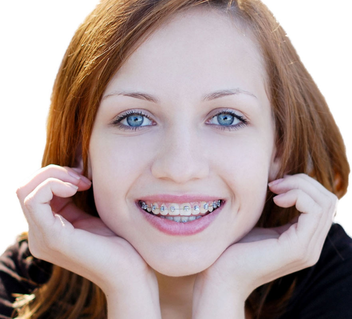 Orthodontic Treatment