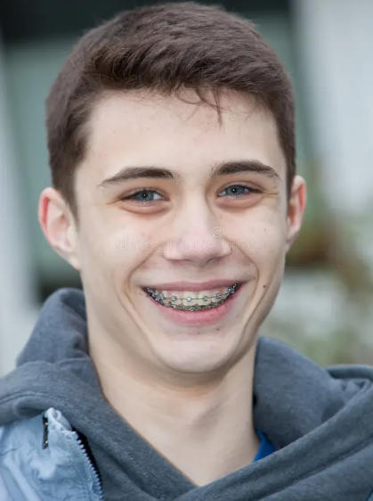 Orthodontic Treatment