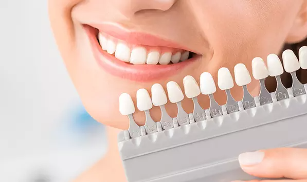 Teeth Whitening