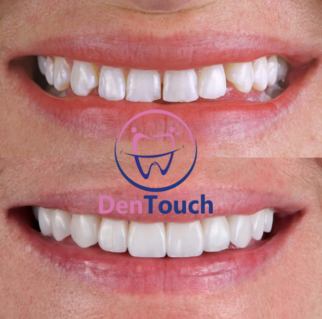 Cosmetic dentistry