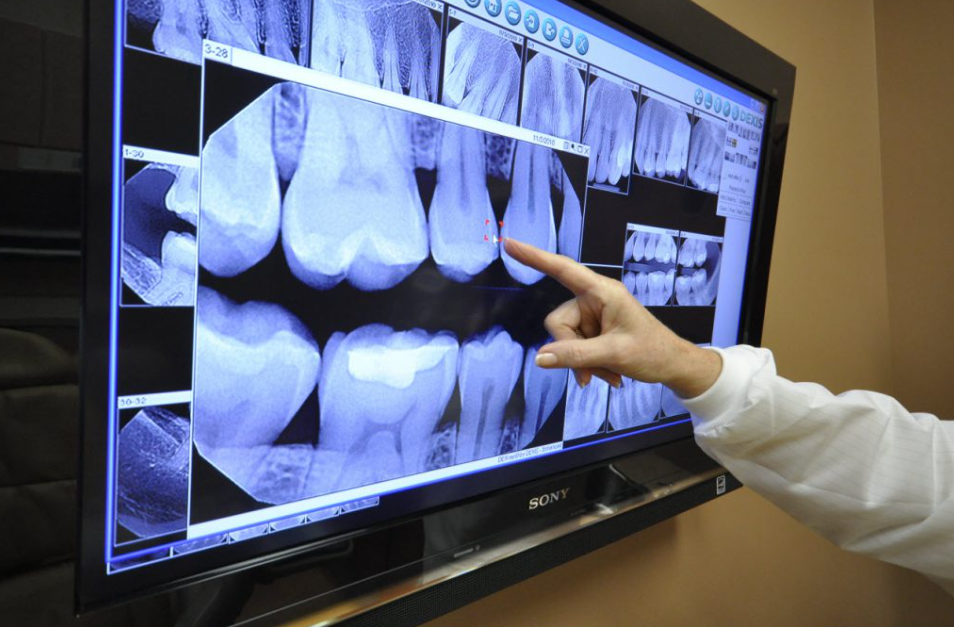 Digital Dental X-ray